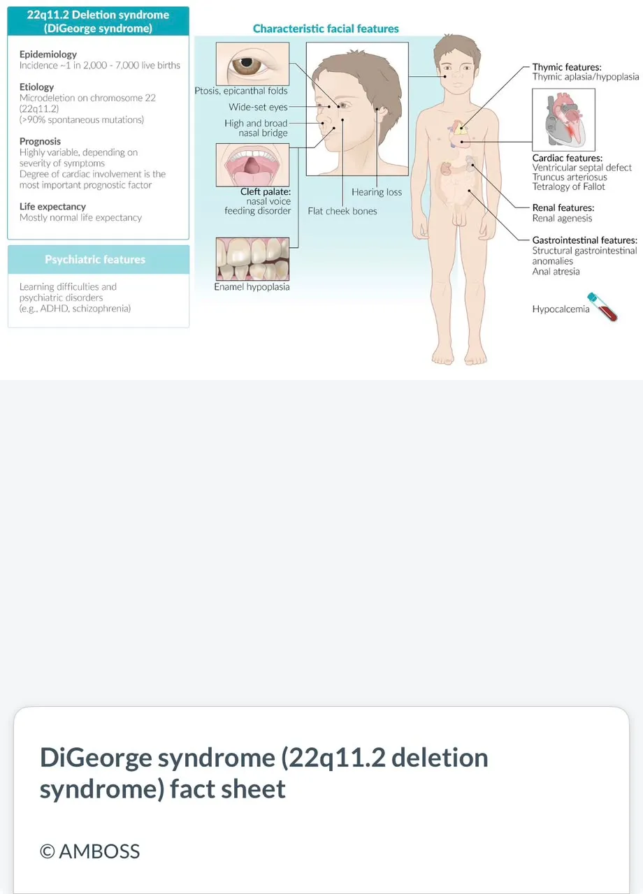 AMBOSS fact sheet of DiGeorge syndrome
